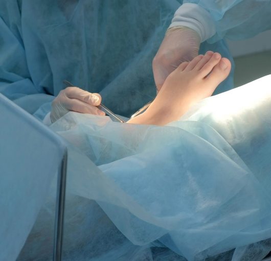 Surgeon man making surgery of removal ankle hygroma on leg in hospital in operating room, hands closeup. Doctor using medical tools clamp and tweezers. Surgical treatment of hygroma.